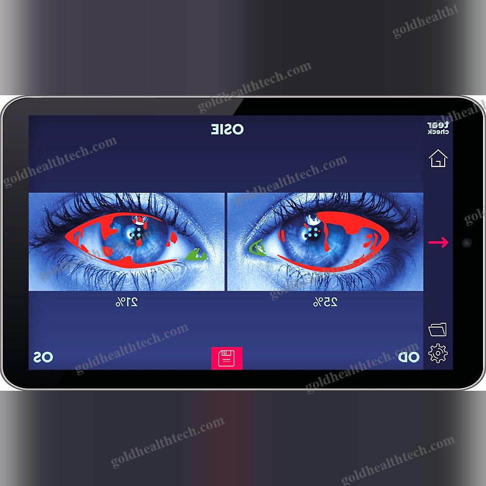 Meibography Dry Eye Diagnosis System