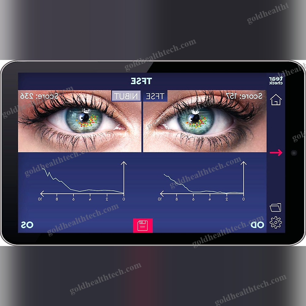 Meibography Dry Eye Diagnosis System