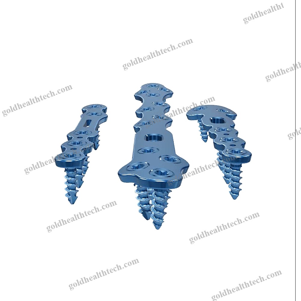 Tarso-Metatarsal Joint Arthrodesis Plate