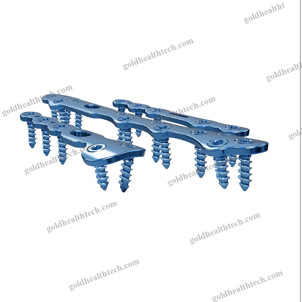 Tarso-Metatarsal Joint Arthrodesis Plate