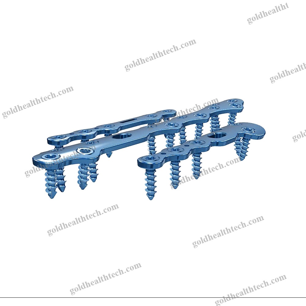 Tarso-Metatarsal Joint Arthrodesis Plate