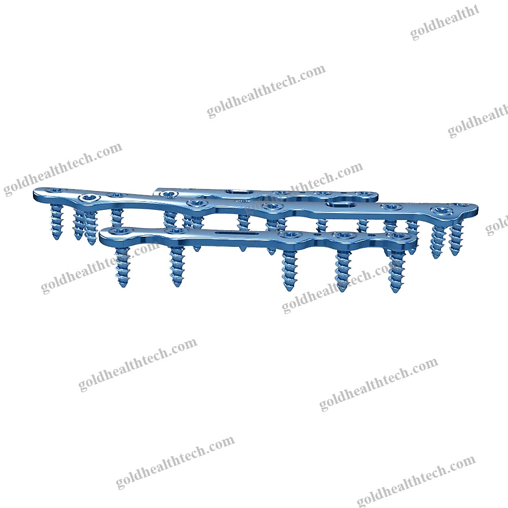 Tarso-Metatarsal Joint Arthrodesis Plate