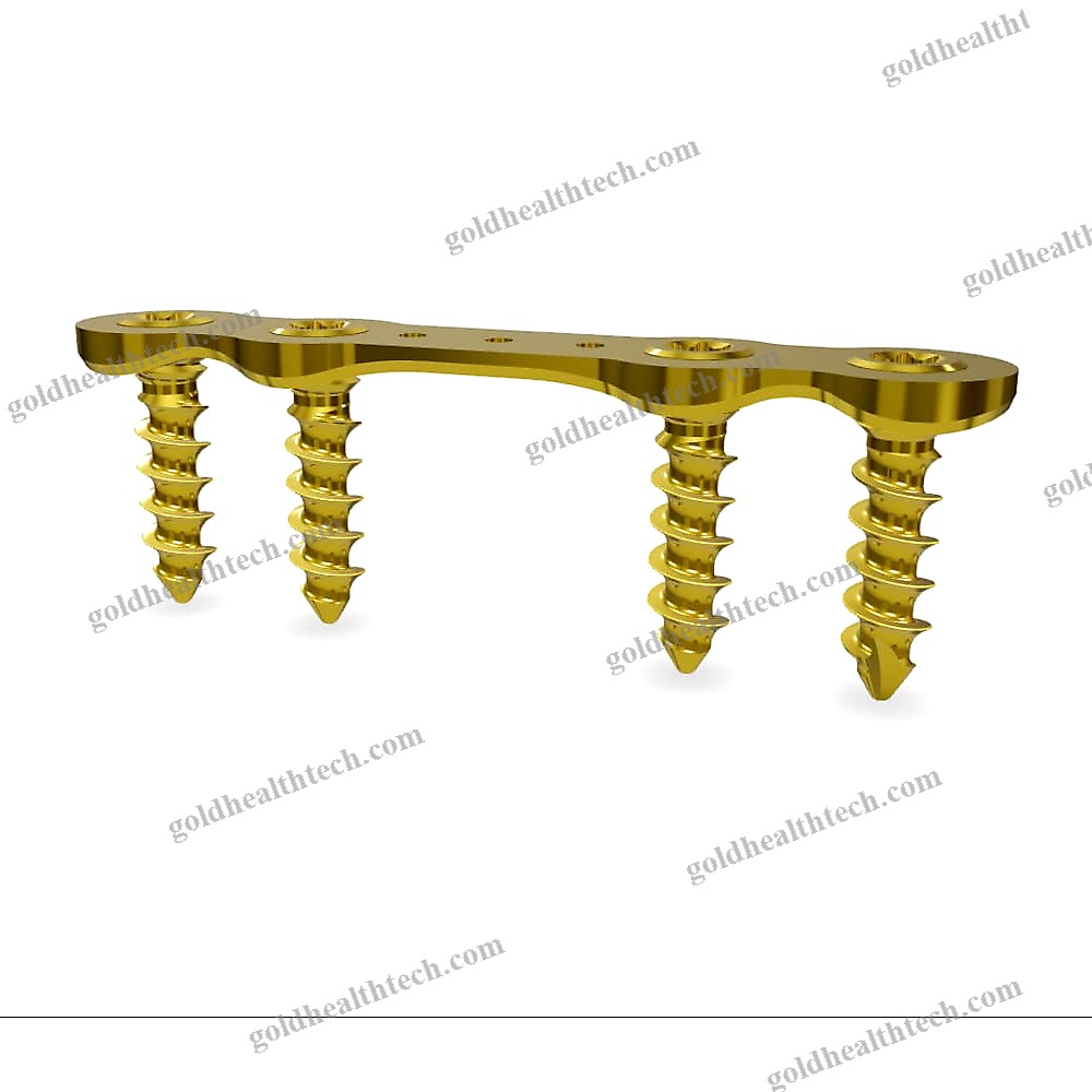Hallux Valgus Arthrodesis Plate
