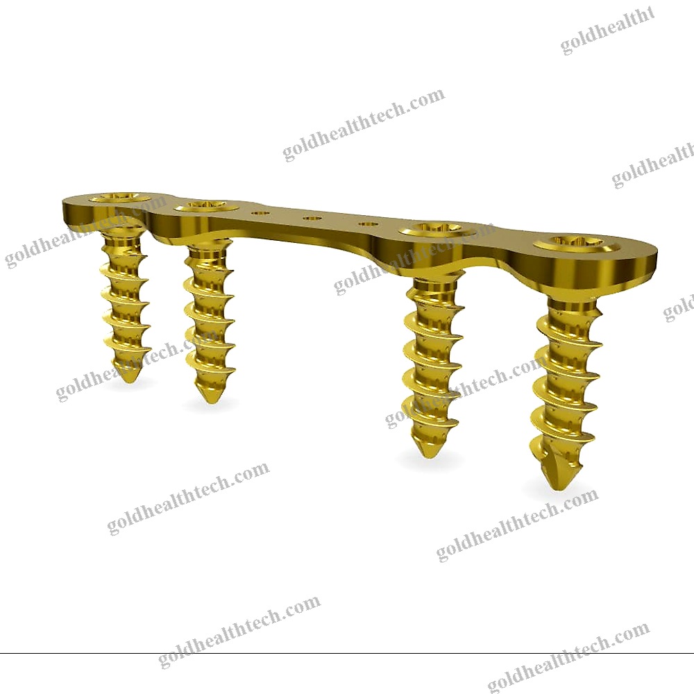 Hallux Valgus Arthrodesis Plate