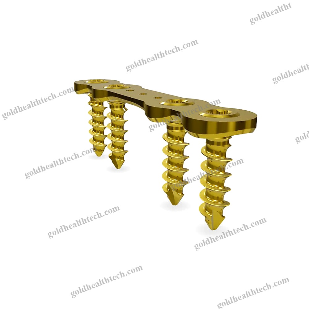 Hallux Valgus Arthrodesis Plate