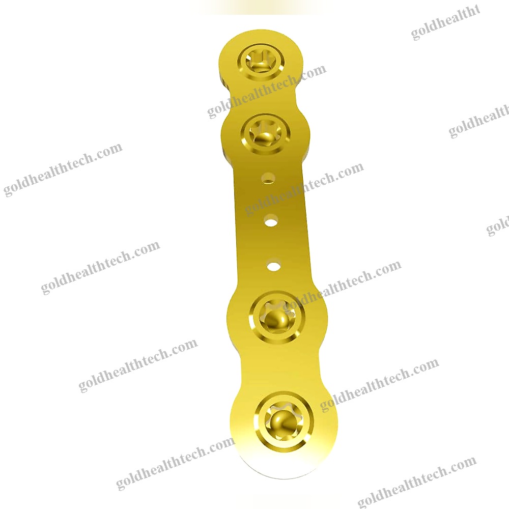 Hallux Valgus Arthrodesis Plate