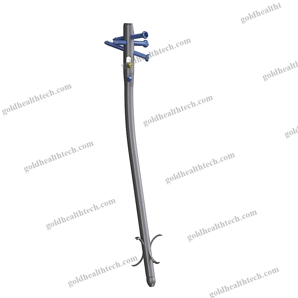 Tibial Intramedullary Nail