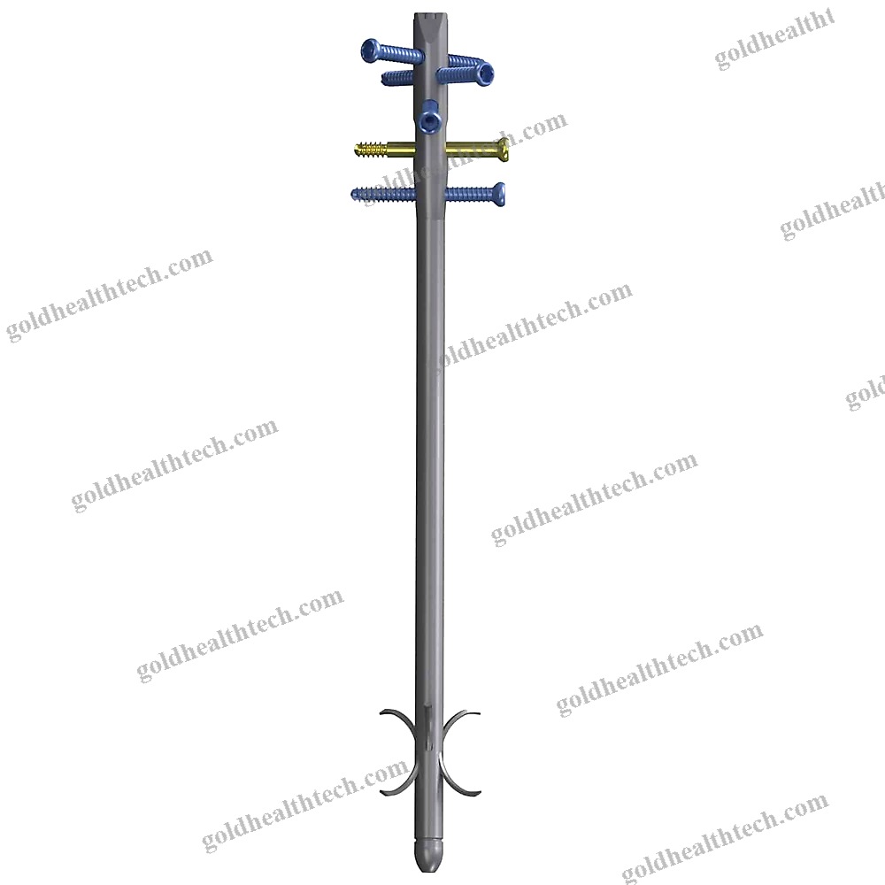 Tibial Intramedullary Nail