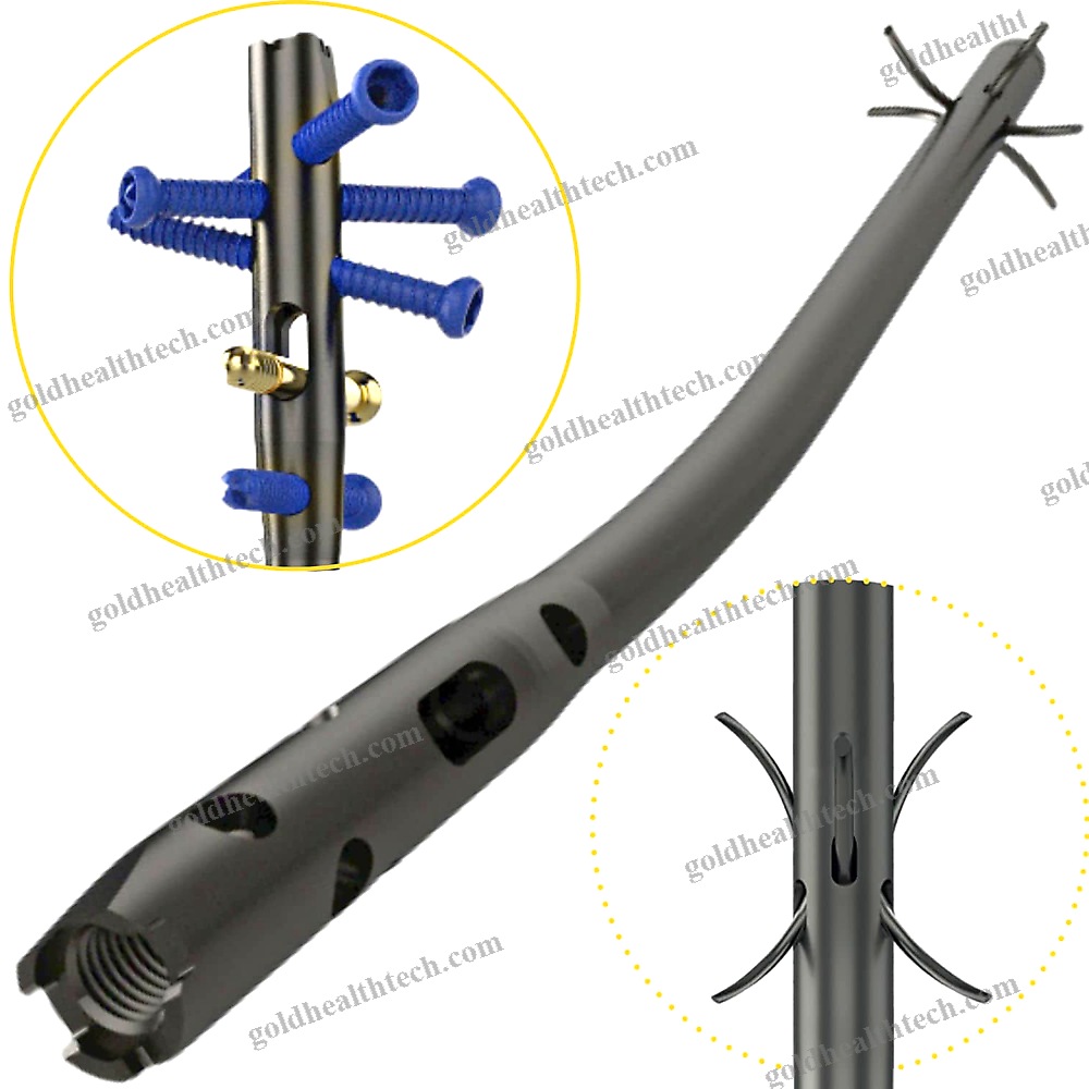 Tibial Intramedullary Nail