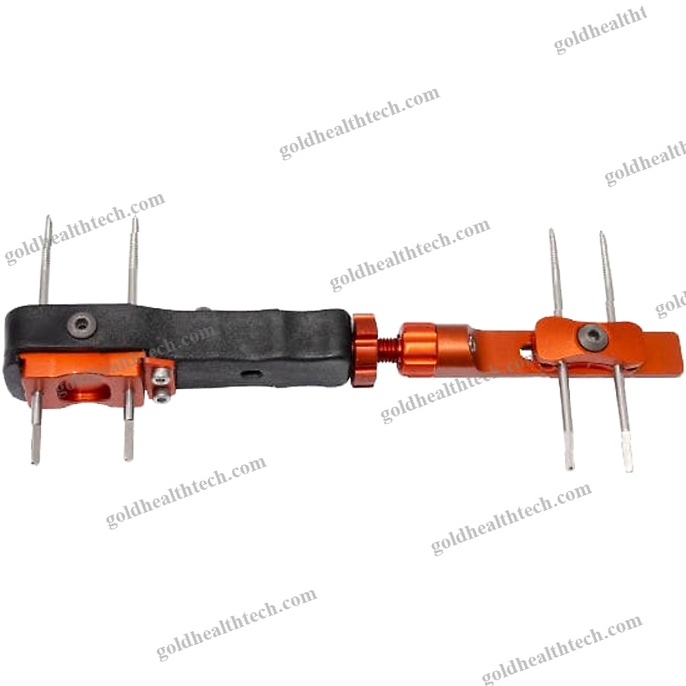 Wrist External Fixation System