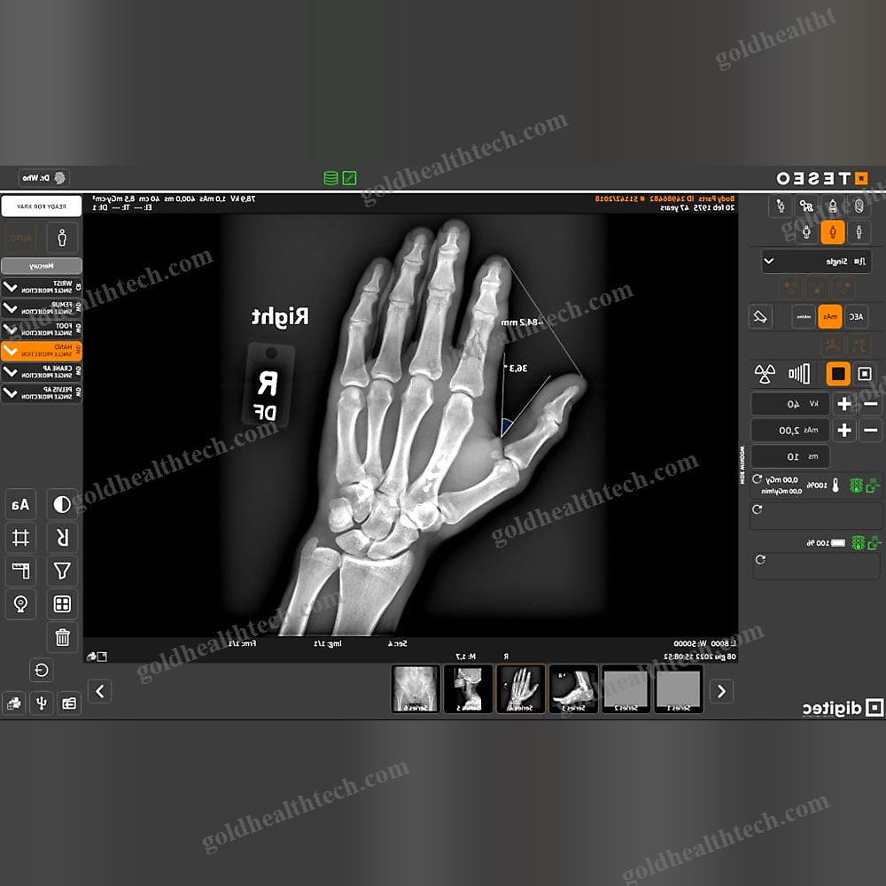 Anatomical Imaging Software