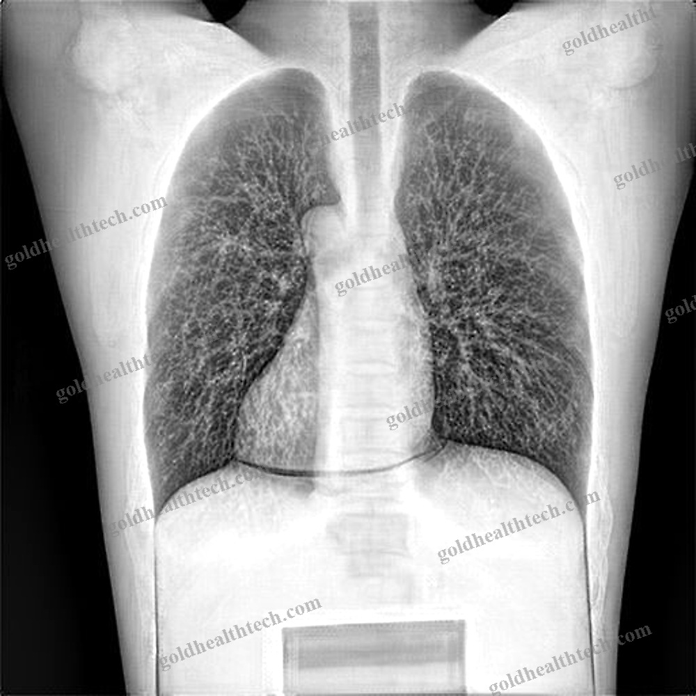 Anatomical Imaging Software