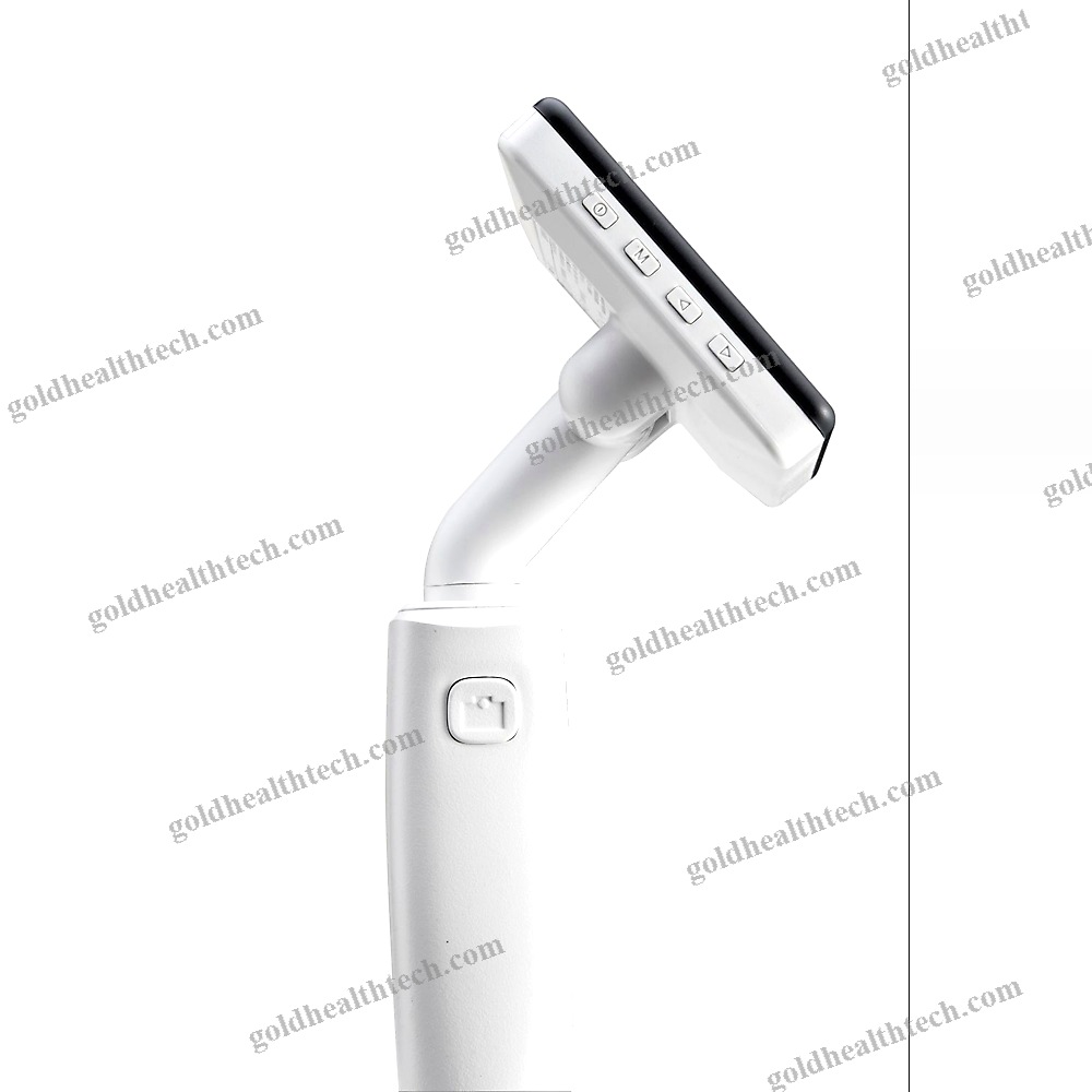 High-Definition Video Laryngoscope