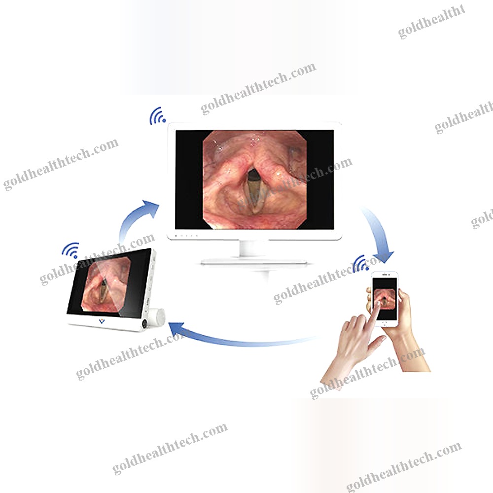 Ent Endoscopy Column