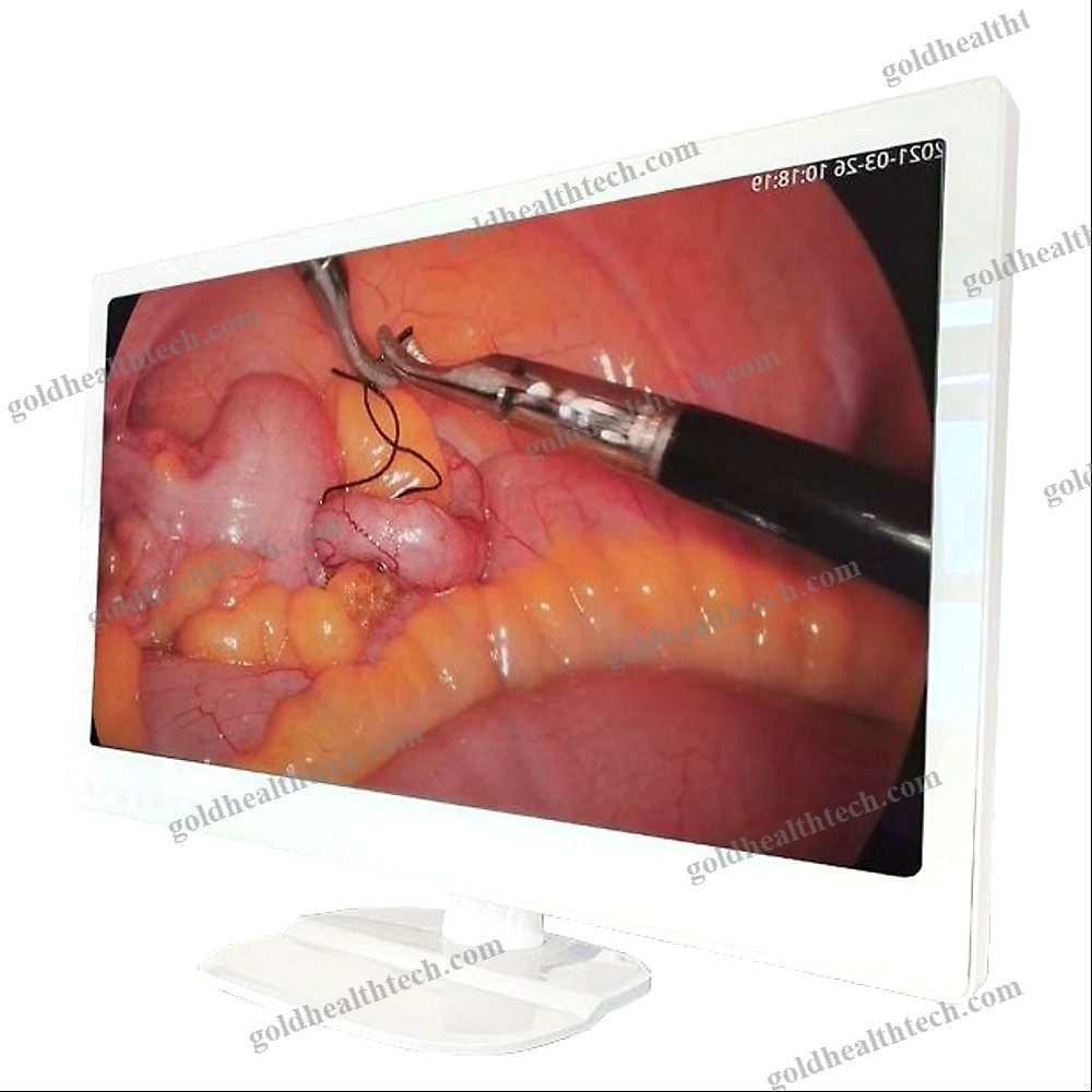 Medical Monitor