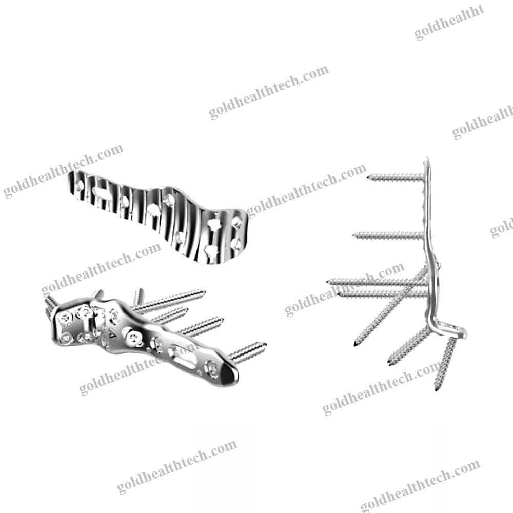 Tibia Compression Plate