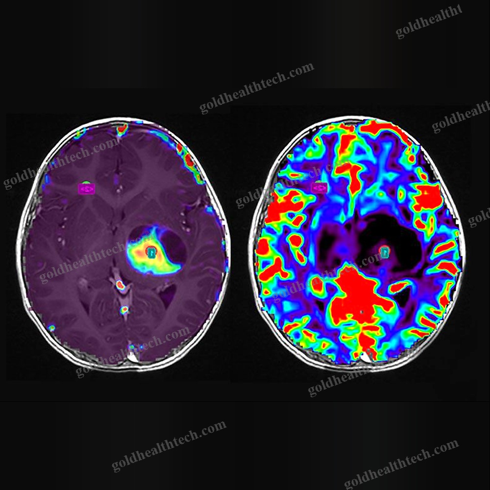 Mri Software