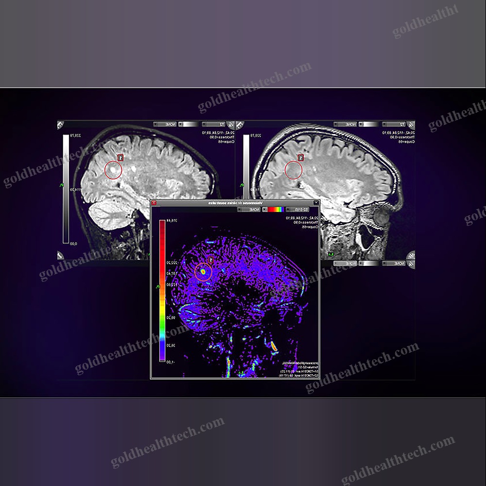 Mri Software