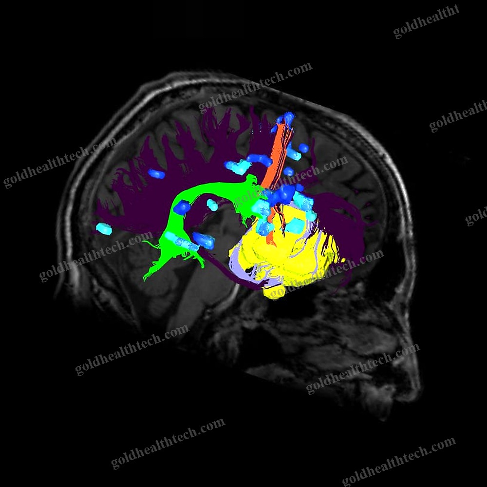 Mri Software