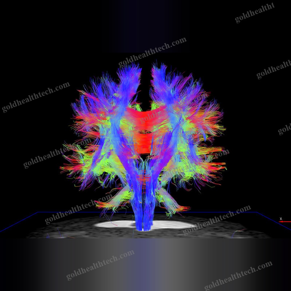 Mri Software