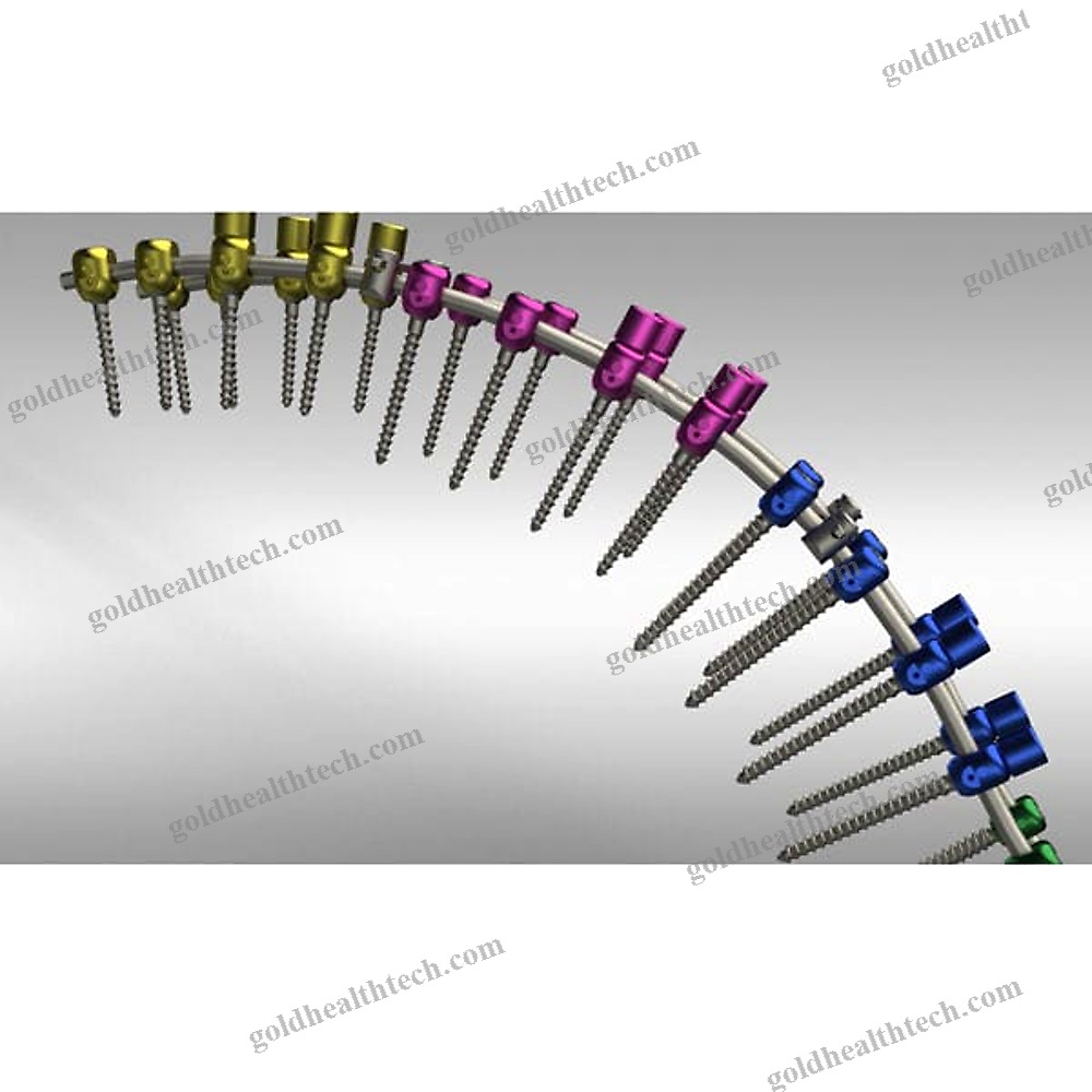 Thoraco-Lumbar Osteosynthesis Unit