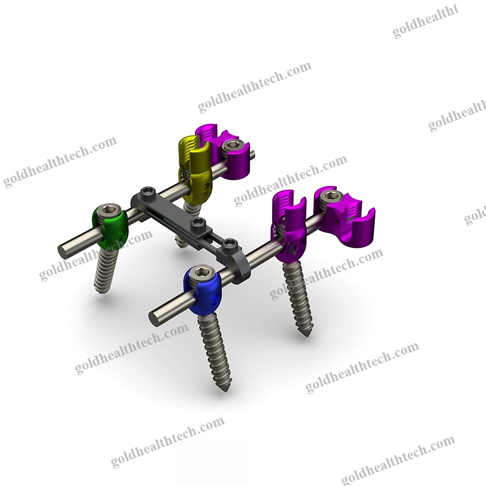 Thoraco-Lumbar Osteosynthesis Unit