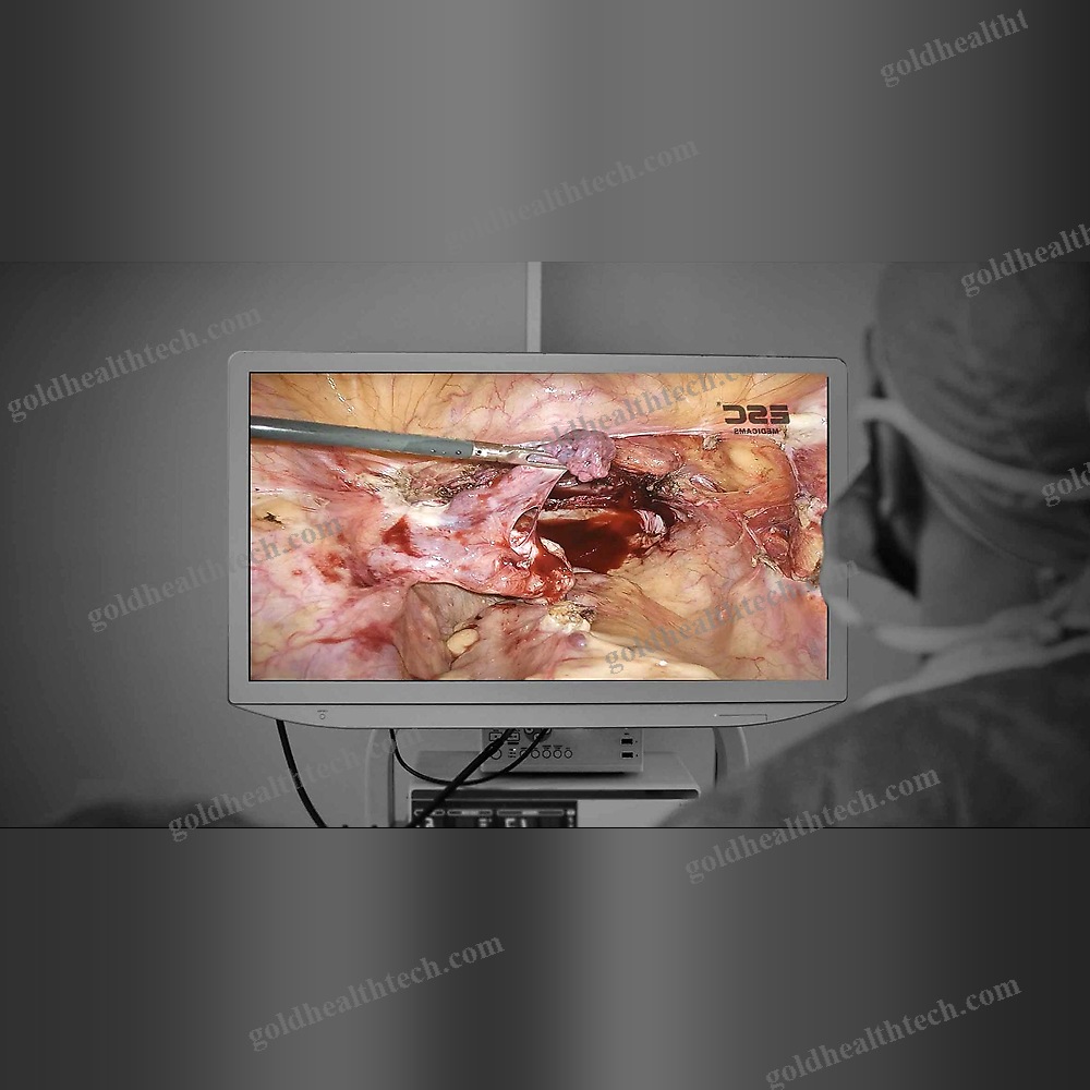 Endoscopic Camera