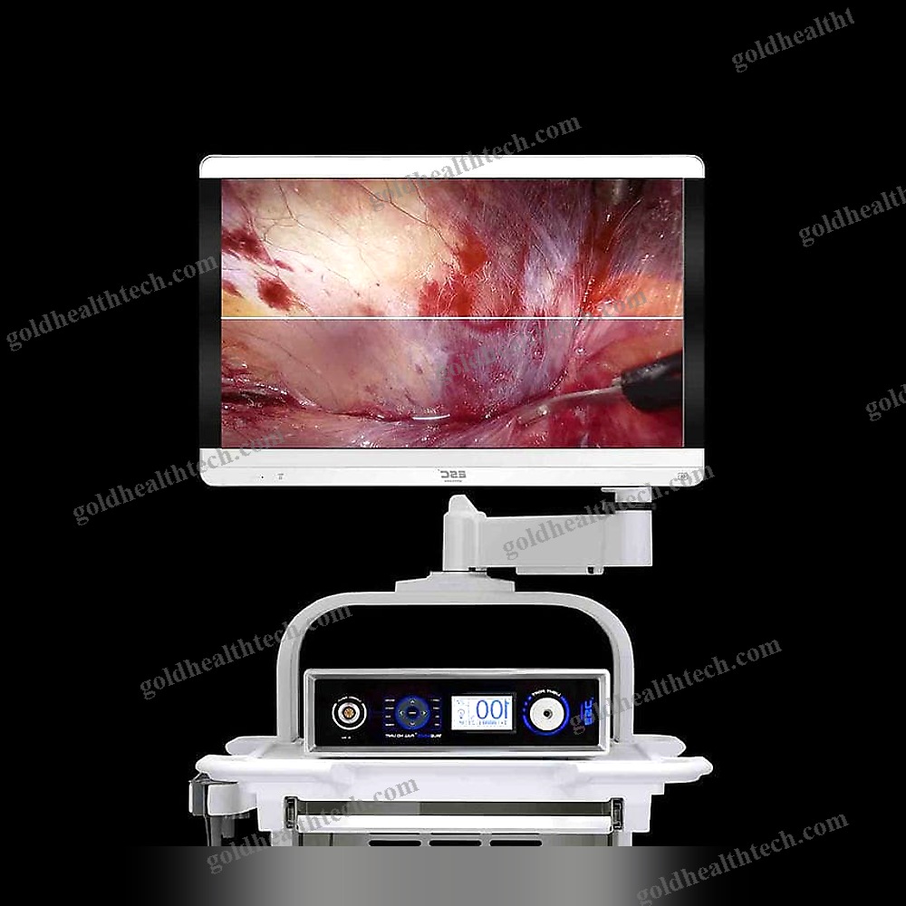 Endoscopic Camera