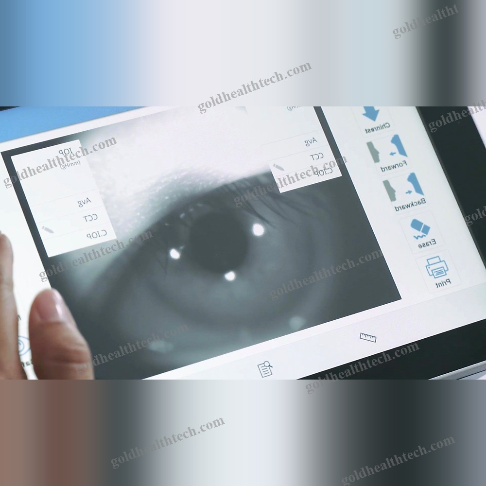 Tonometer