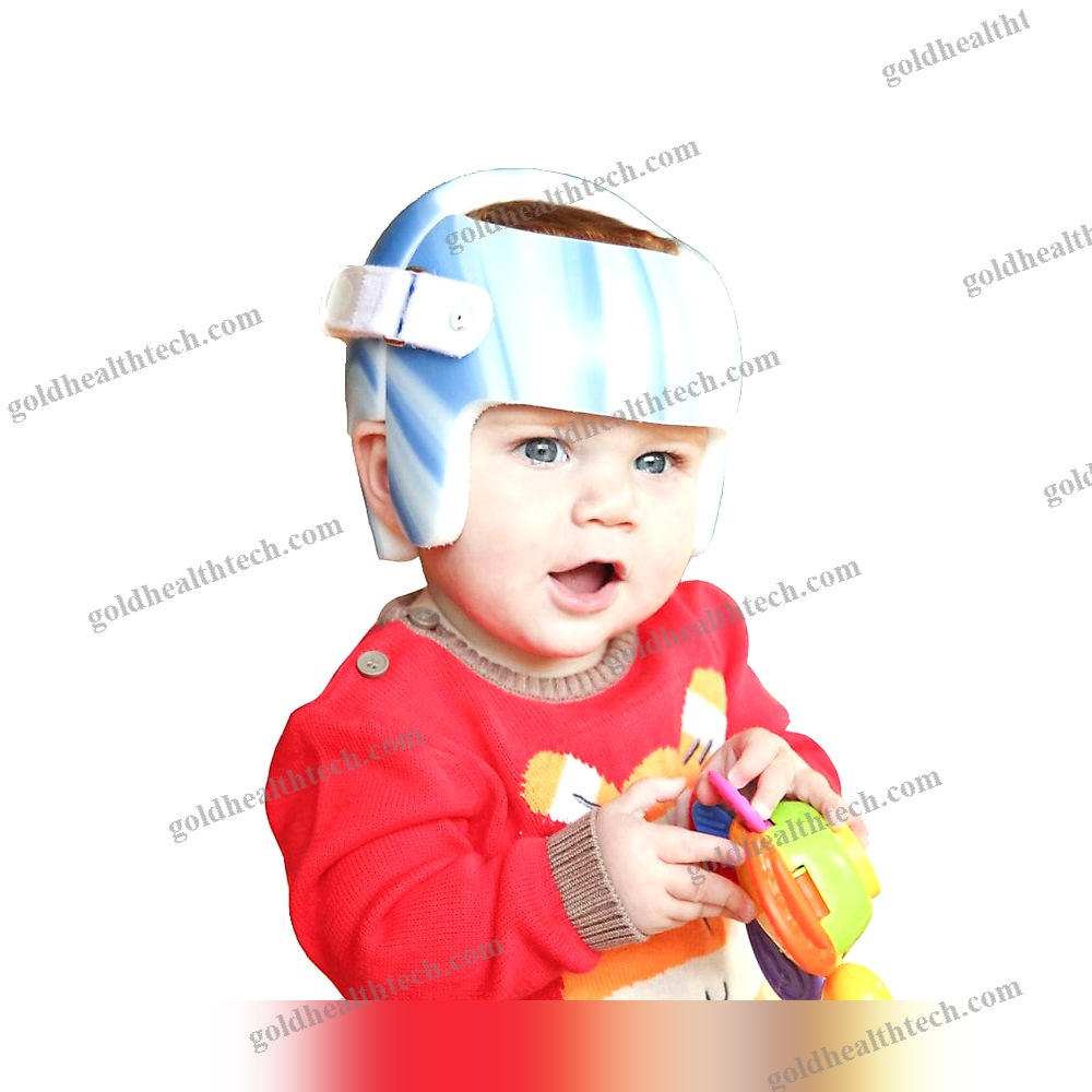Cranial Orthosis