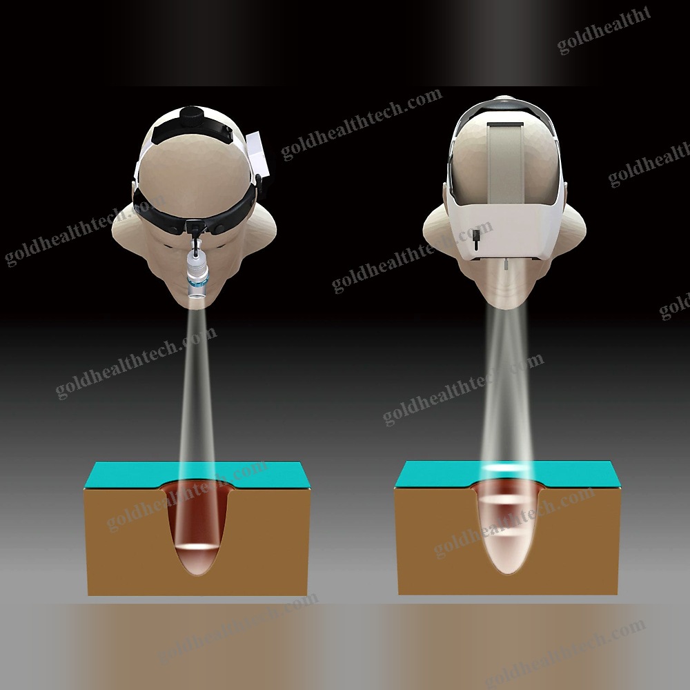 Surgical Headlight