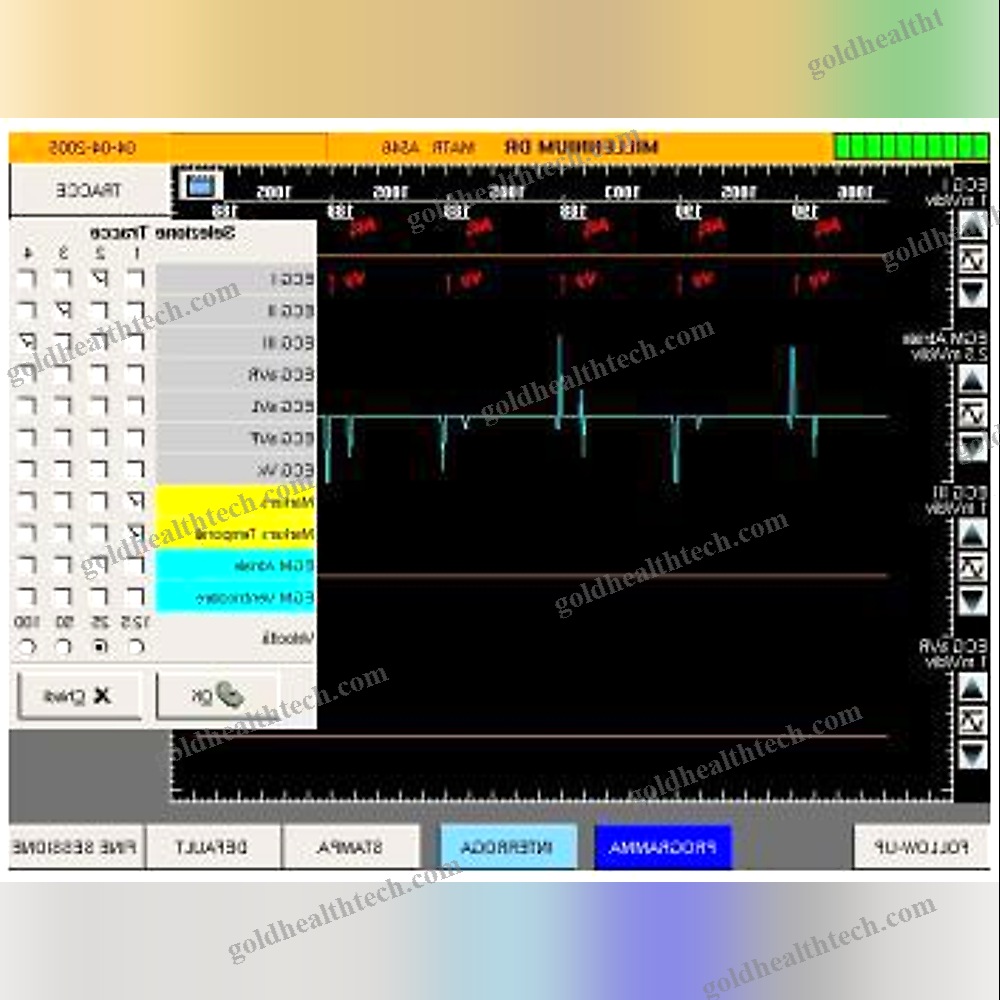 Pacemaker Programming Unit
