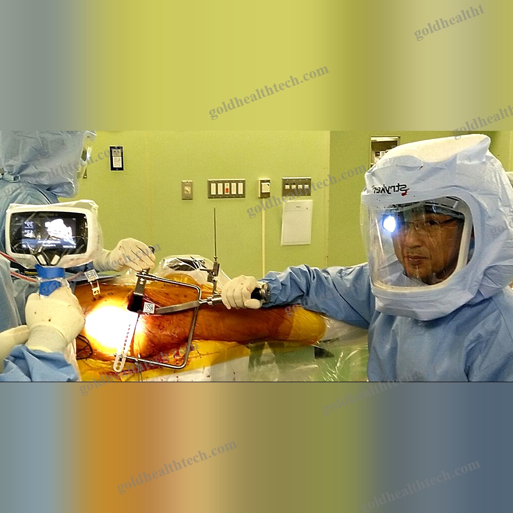 Orthopedic Surgery Surgical Navigation System