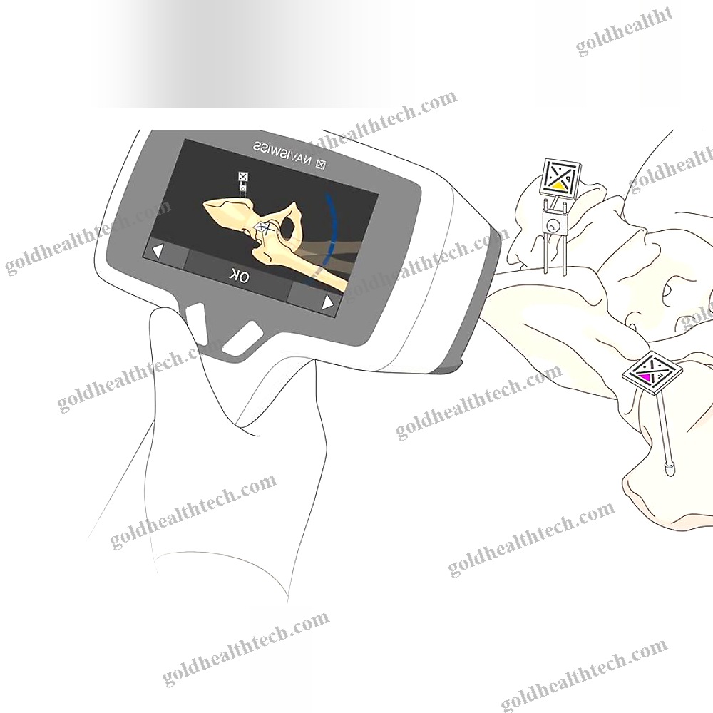 Orthopedic Surgery Surgical Navigation System