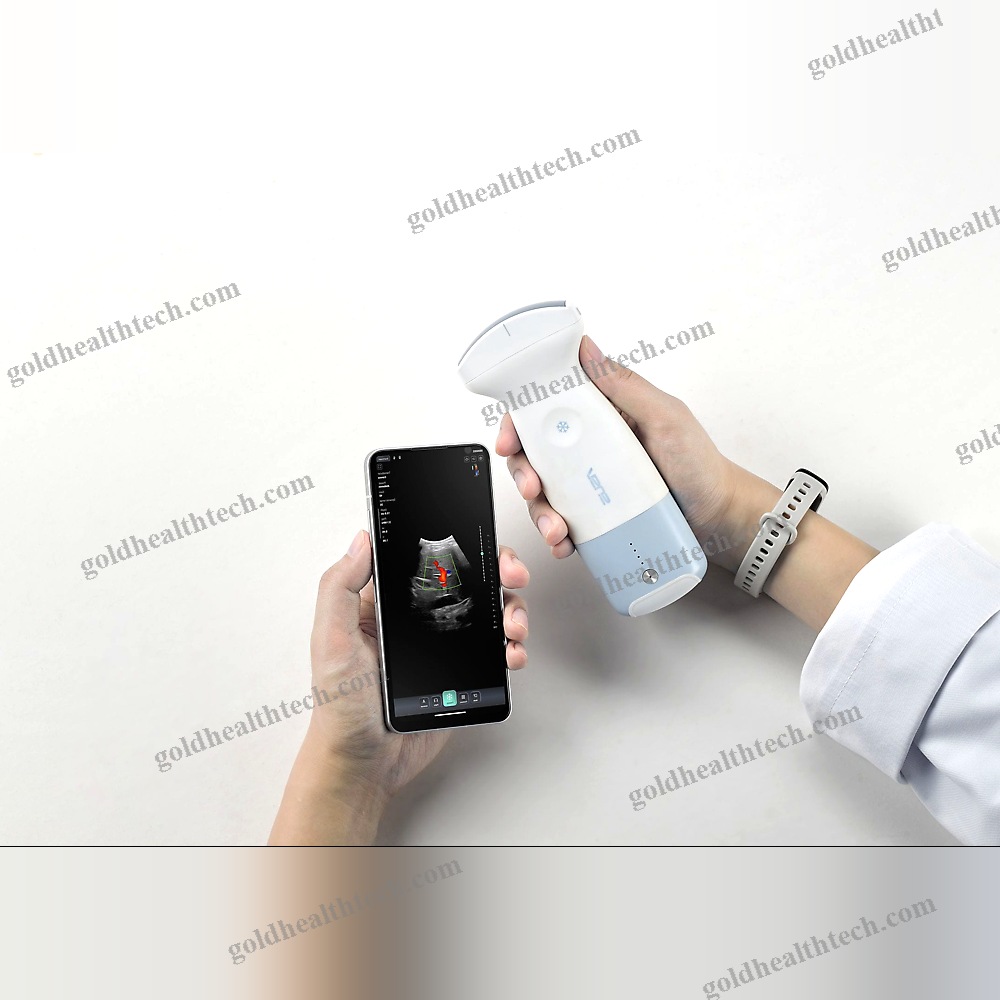 Hand-Held Ultrasound System