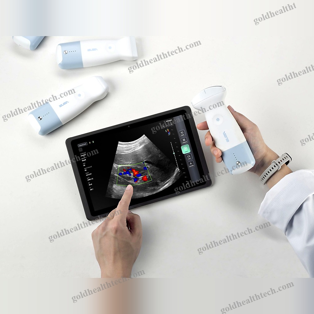 Hand-Held Ultrasound System