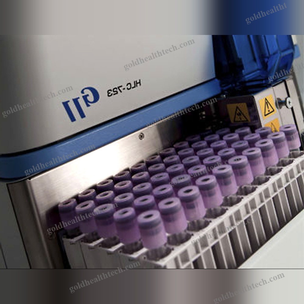 Automated Hba1C Analyzer
