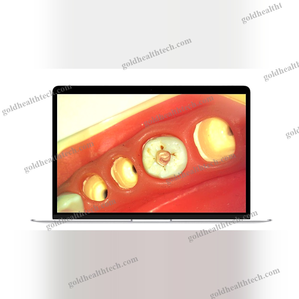 Dental Surgery Microscope