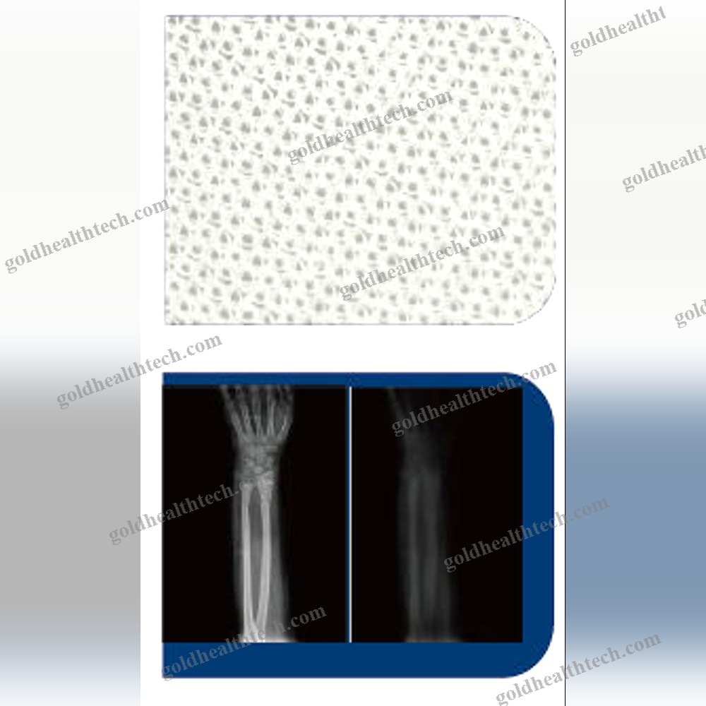 Wound Dressing