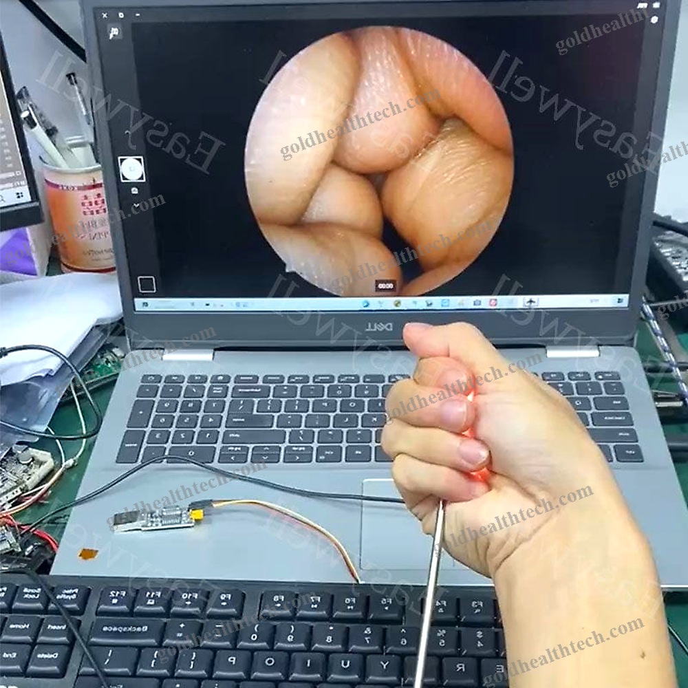 Medical Camera