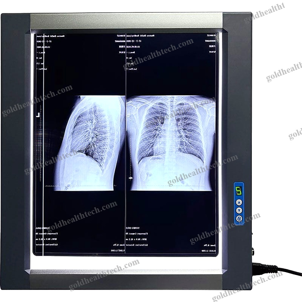 Led X-Ray Film Viewer