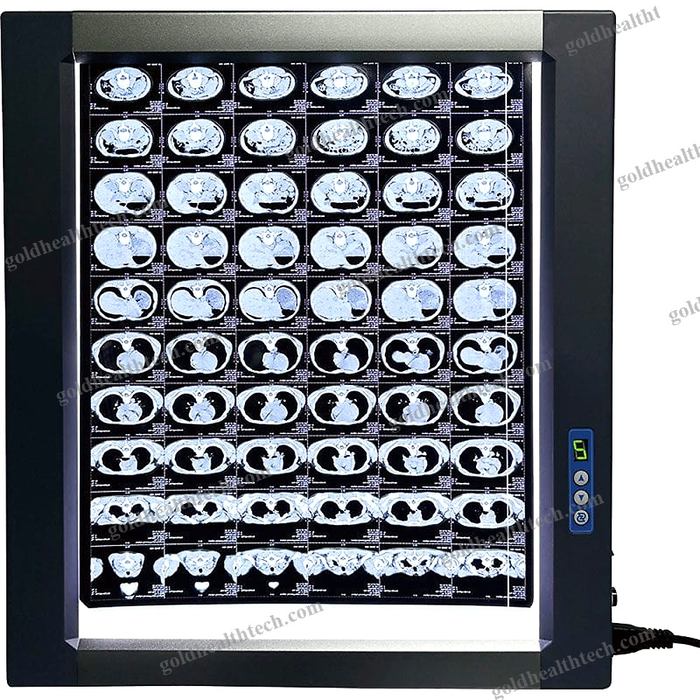 Led X-Ray Film Viewer