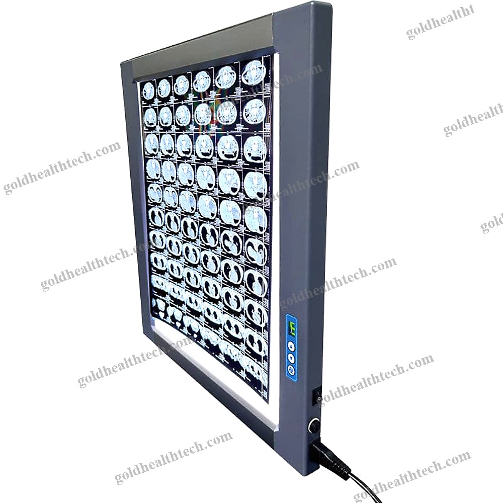 Led X-Ray Film Viewer