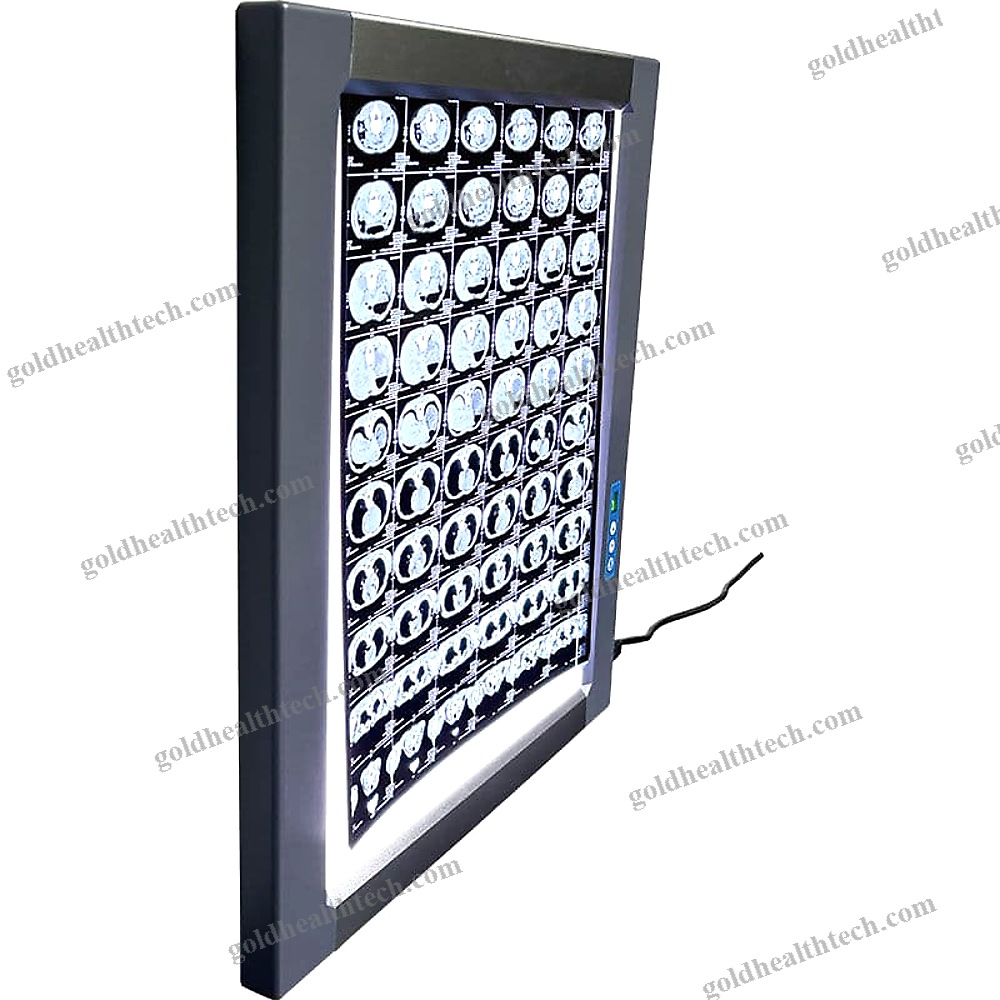 Led X-Ray Film Viewer