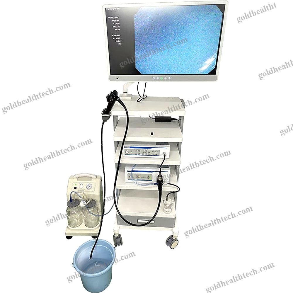 Gastroenterological Endoscopy Column