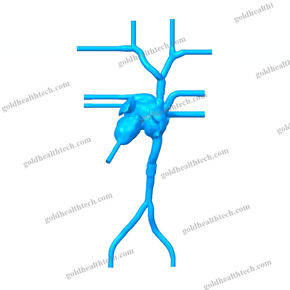 Heart Vascular Model