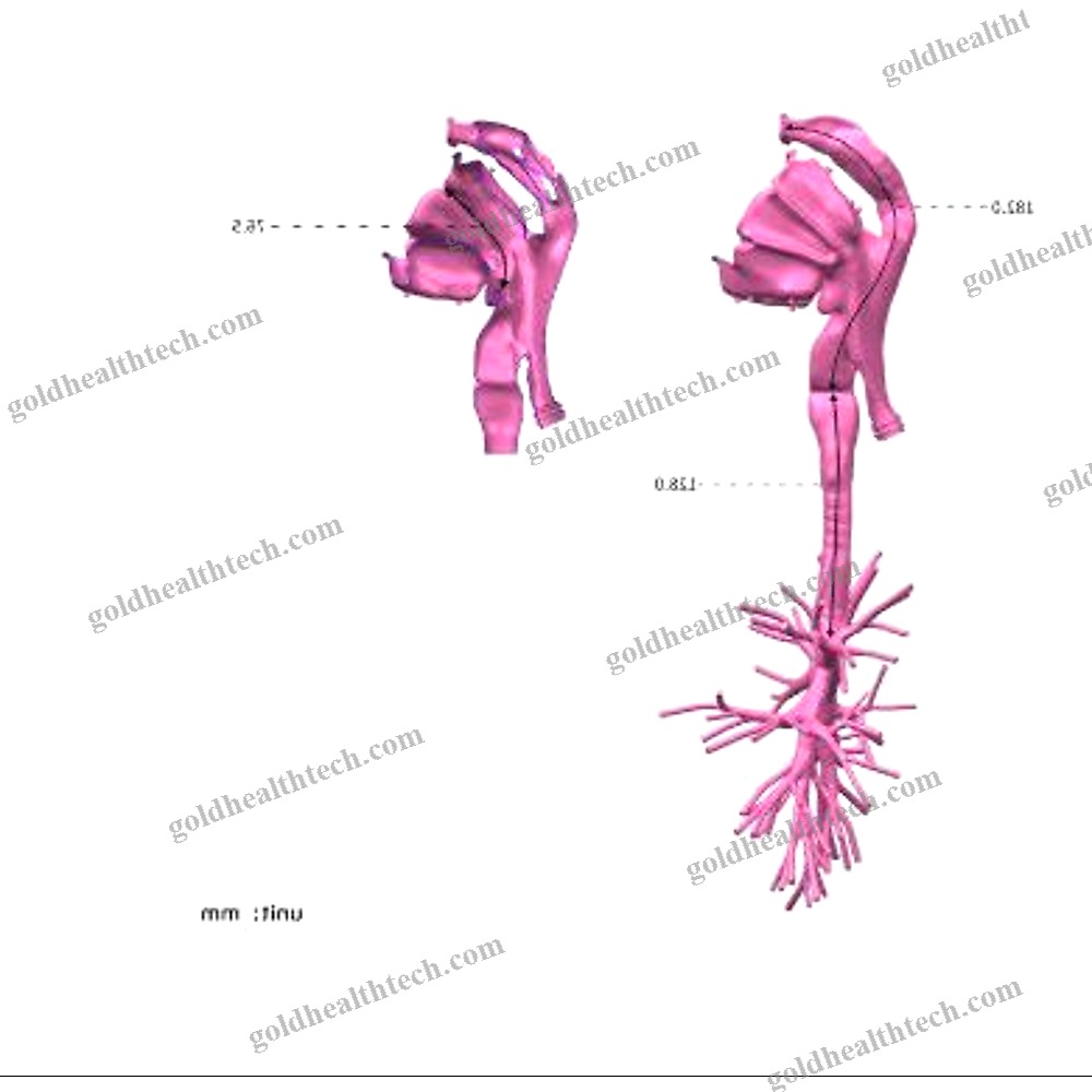 Lung Model