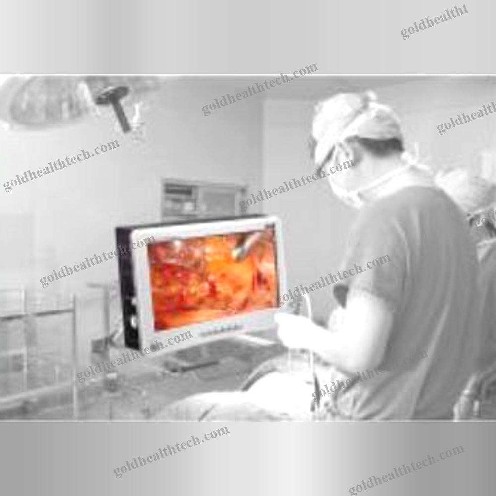 Endoscope Camera