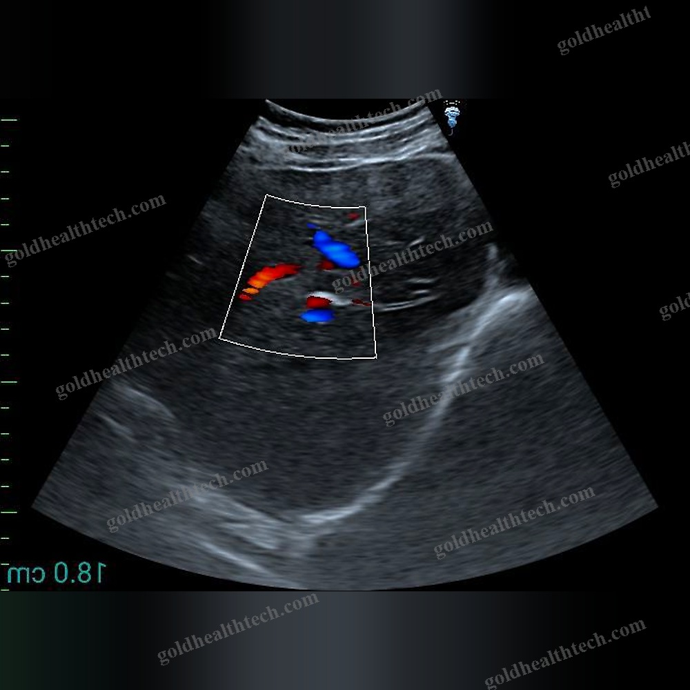 Hand-Held Ultrasound System