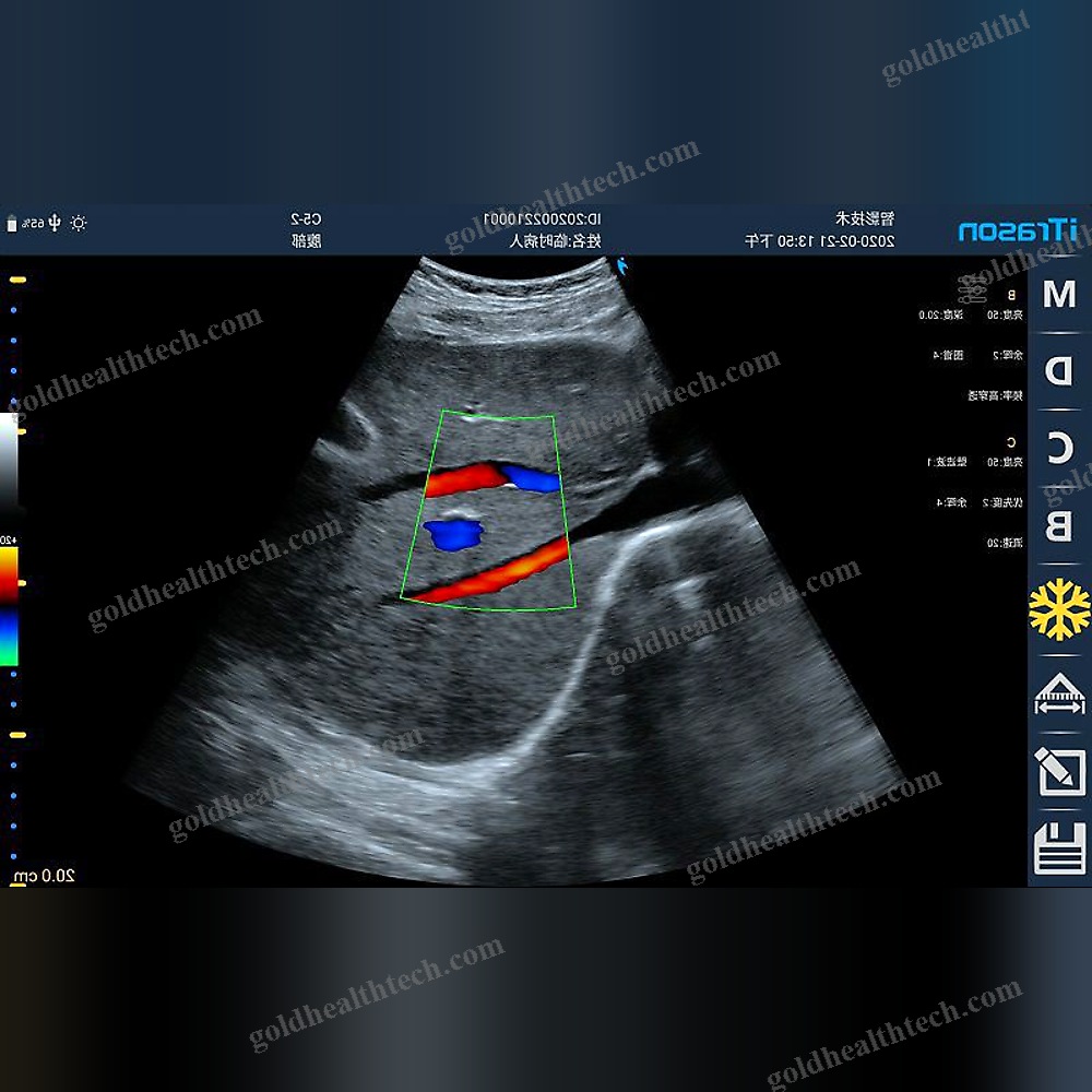 Hand-Held Ultrasound System